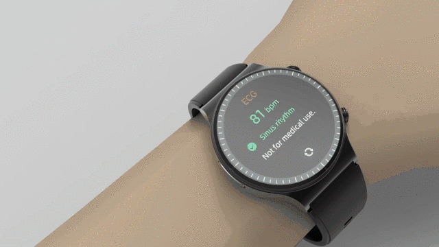 ECG smartwatch